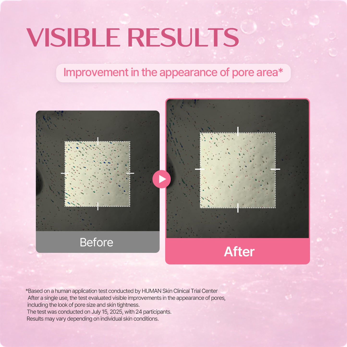 Retinol Pore Ampule